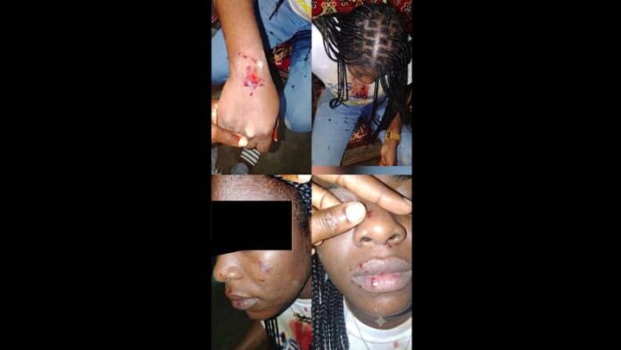 La victime présumée présente des blessures à la suite de l’altercation. Image de Gabon Media Time